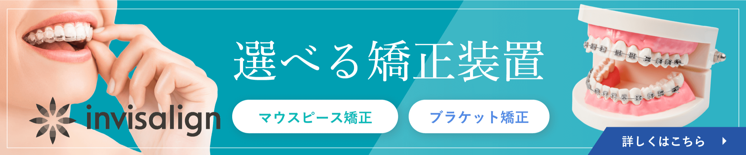 invisalign 選べる矯正装置 マウスピース矯正 ブラケット矯正