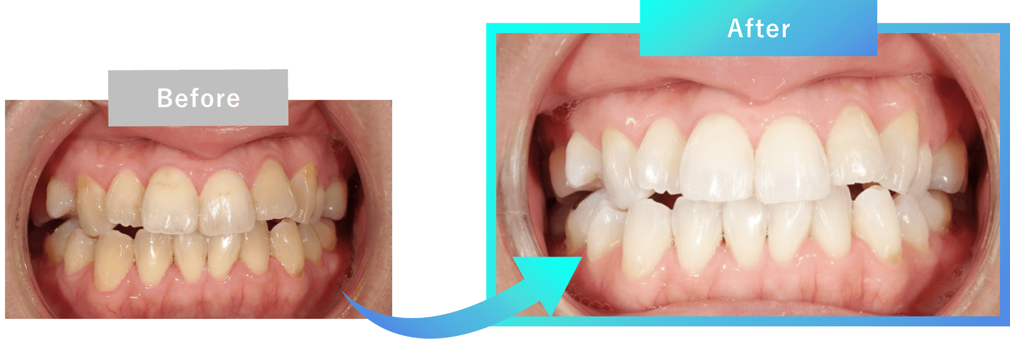 before / after